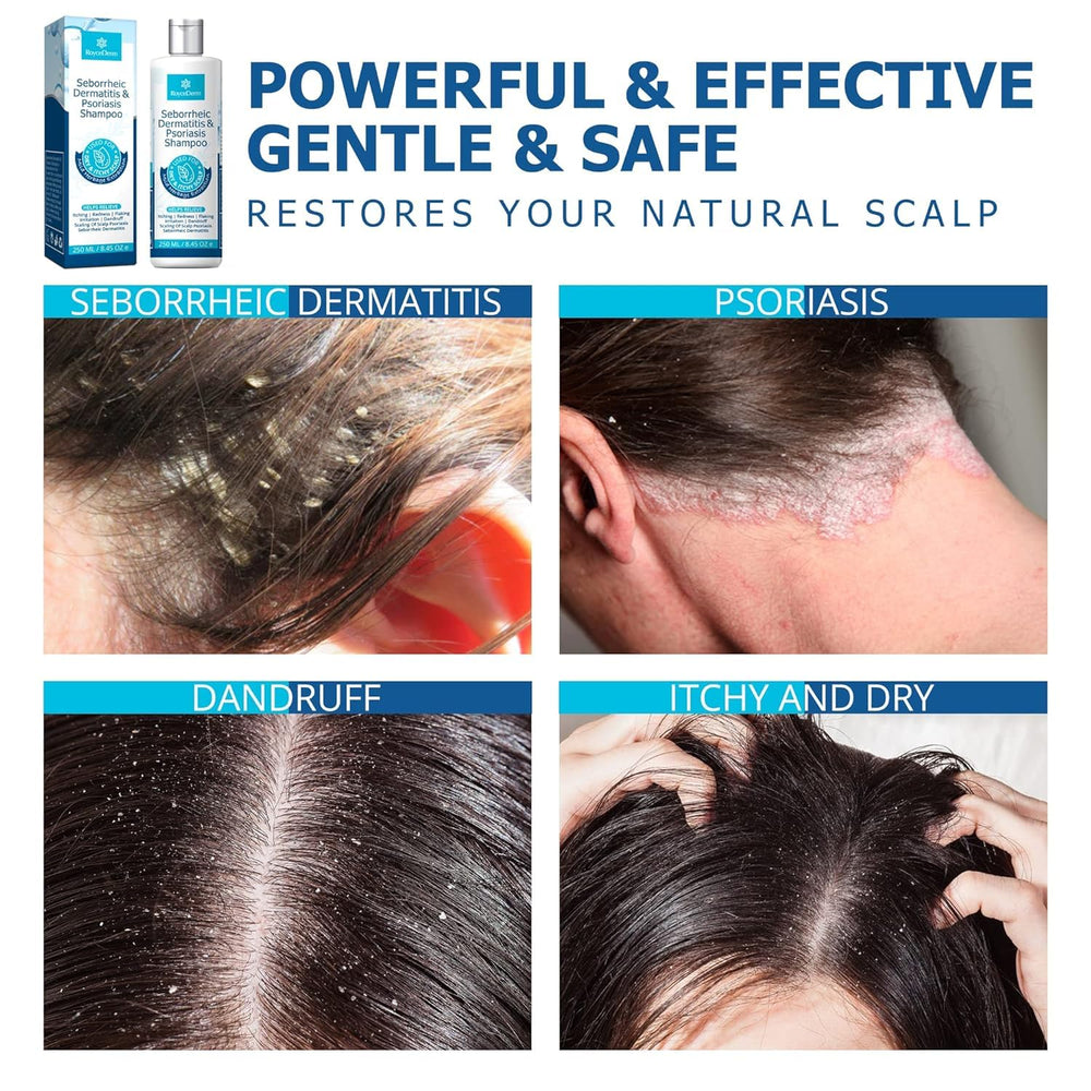 Roycederm scalp massage during wash demonstrates easy application