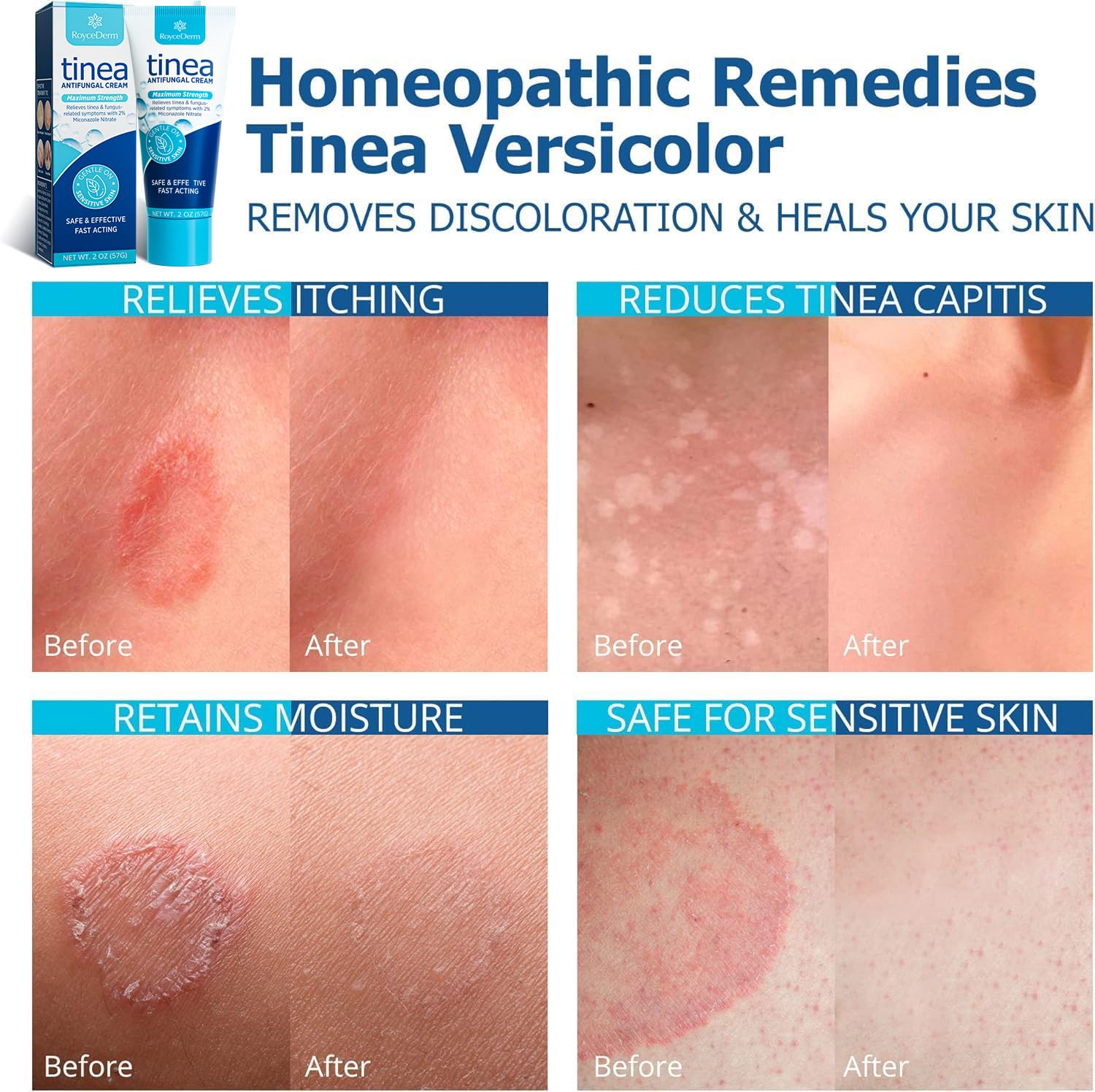 Skin after use looks soothed and moisturized with Roycederm.
