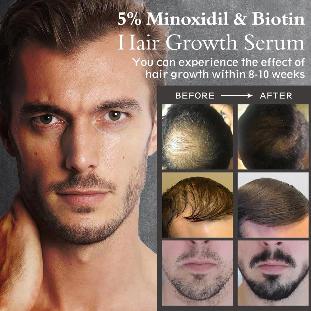 Ruahouine follicle illustration hinting at fuller hair density