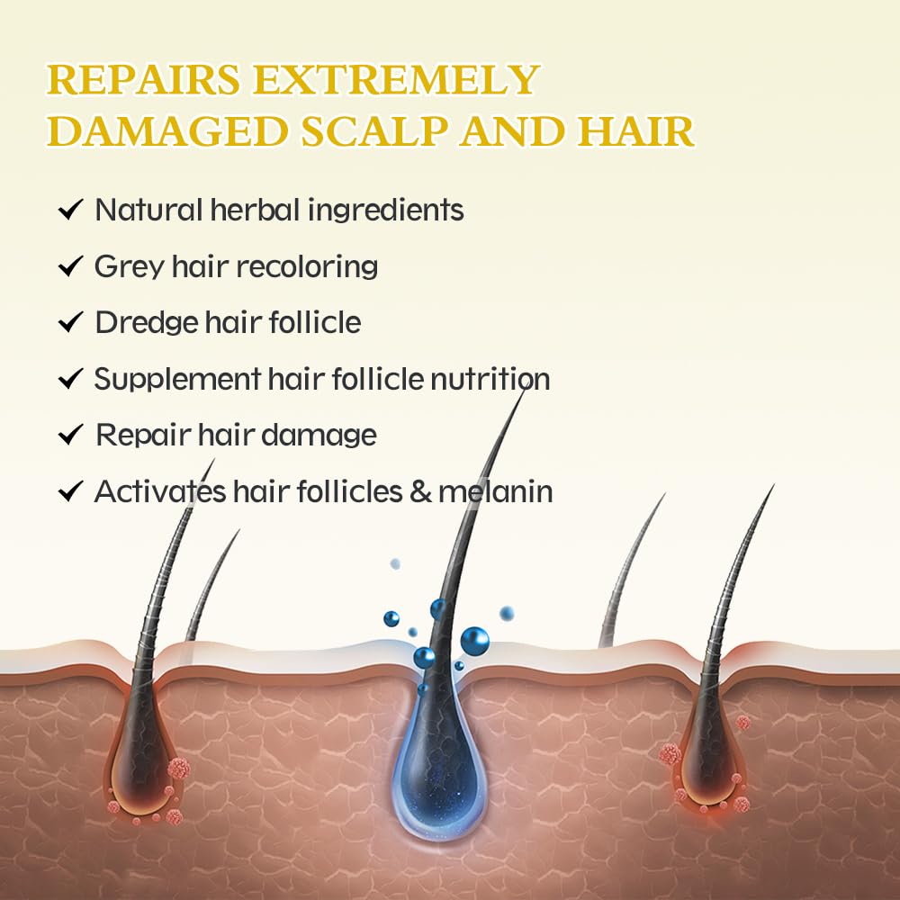 Ruahouine minoxidil serum on scalp during application demonstrates easy use.