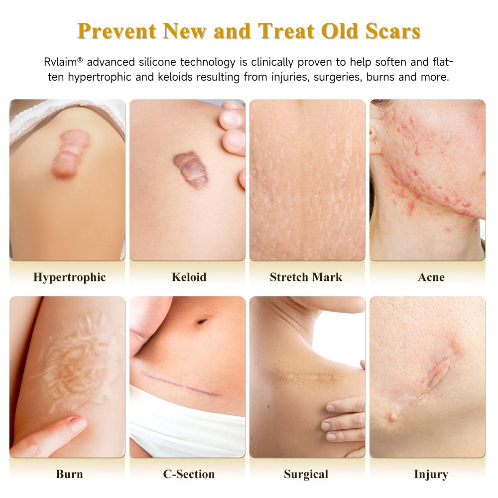 Rvlaim scar cream silicone gel application showing smooth, quick-absorbing coverage.