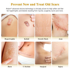 Rvlaim scar cream silicone gel application showing smooth, quick-absorbing coverage.