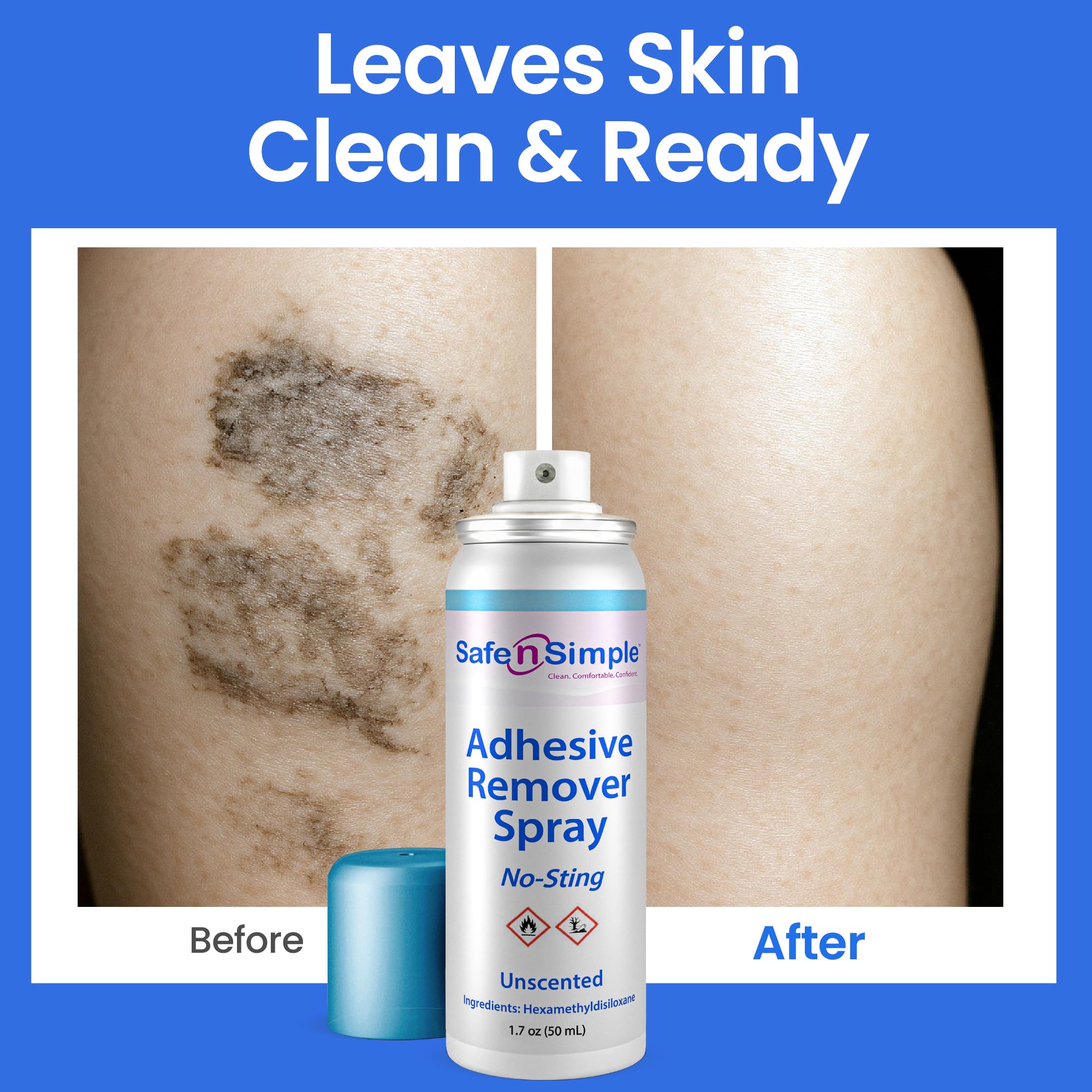 Caregiver uses Safe n’ Simple spray for painless removal without rubbing.