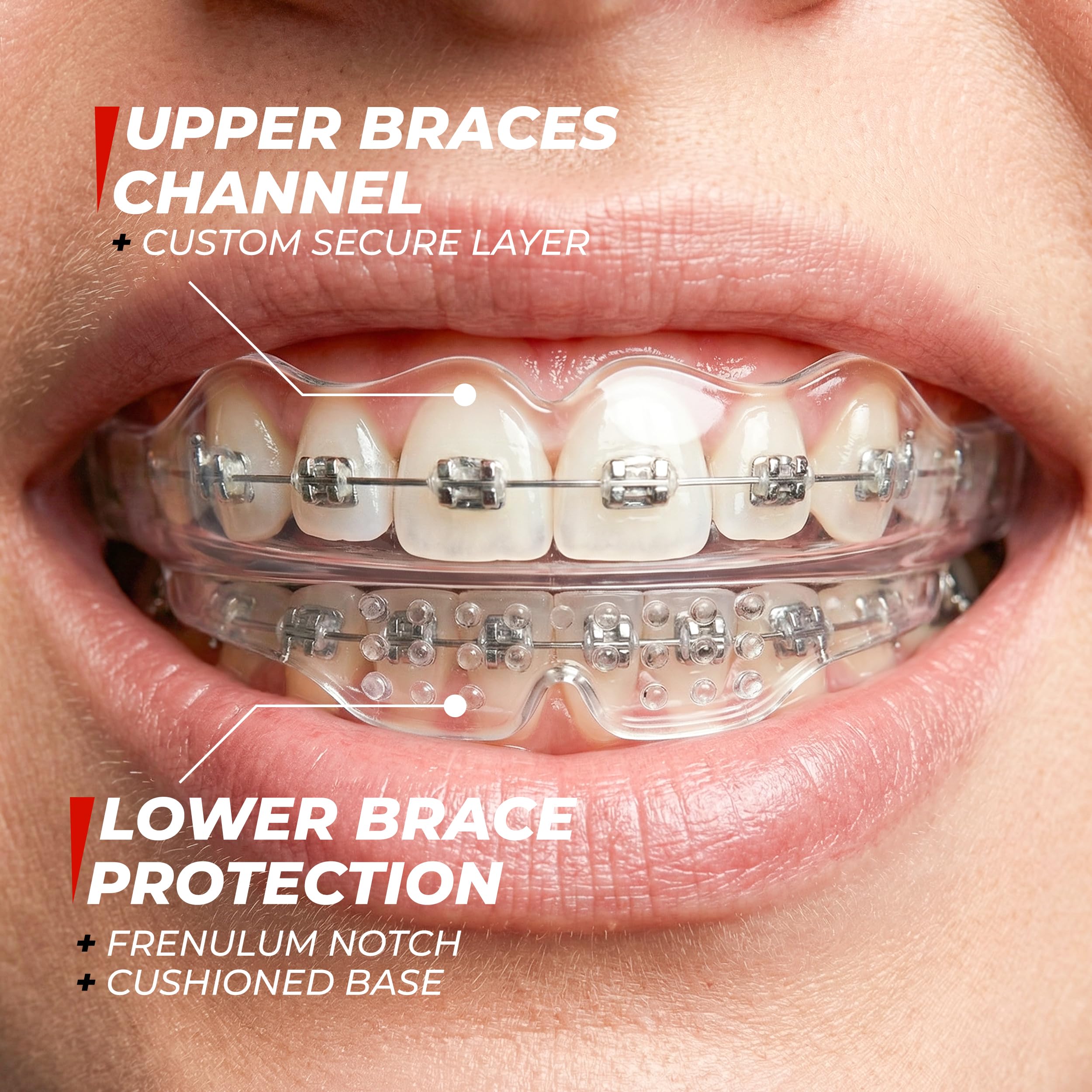 Medical-grade silicone guards comfort and durability in SAFE GRIN mouthguard.