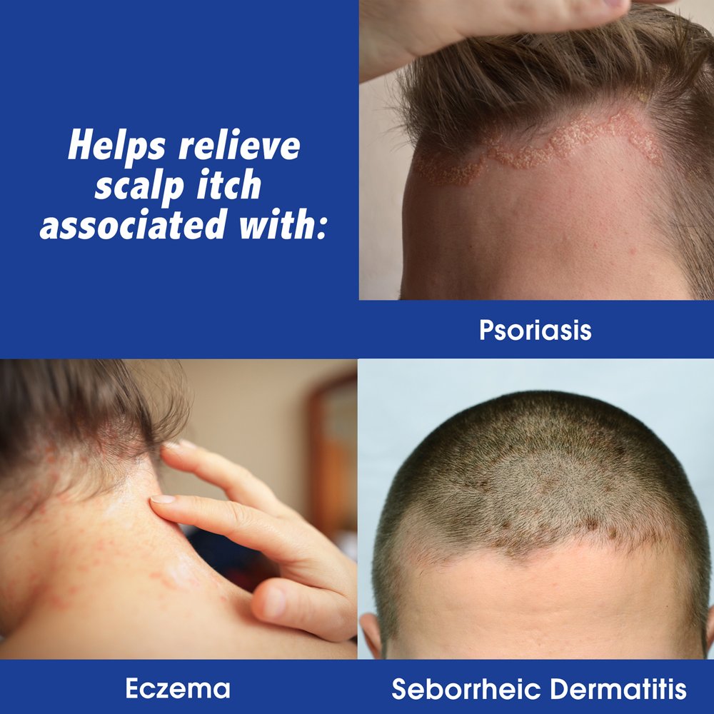 Scalpicin clear formula pour demonstrates easy, greaseless scalp treatment.