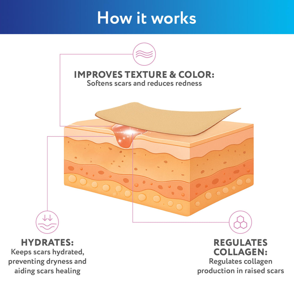 ScarAway silicone strips may help minimize scar visibility with regular use.