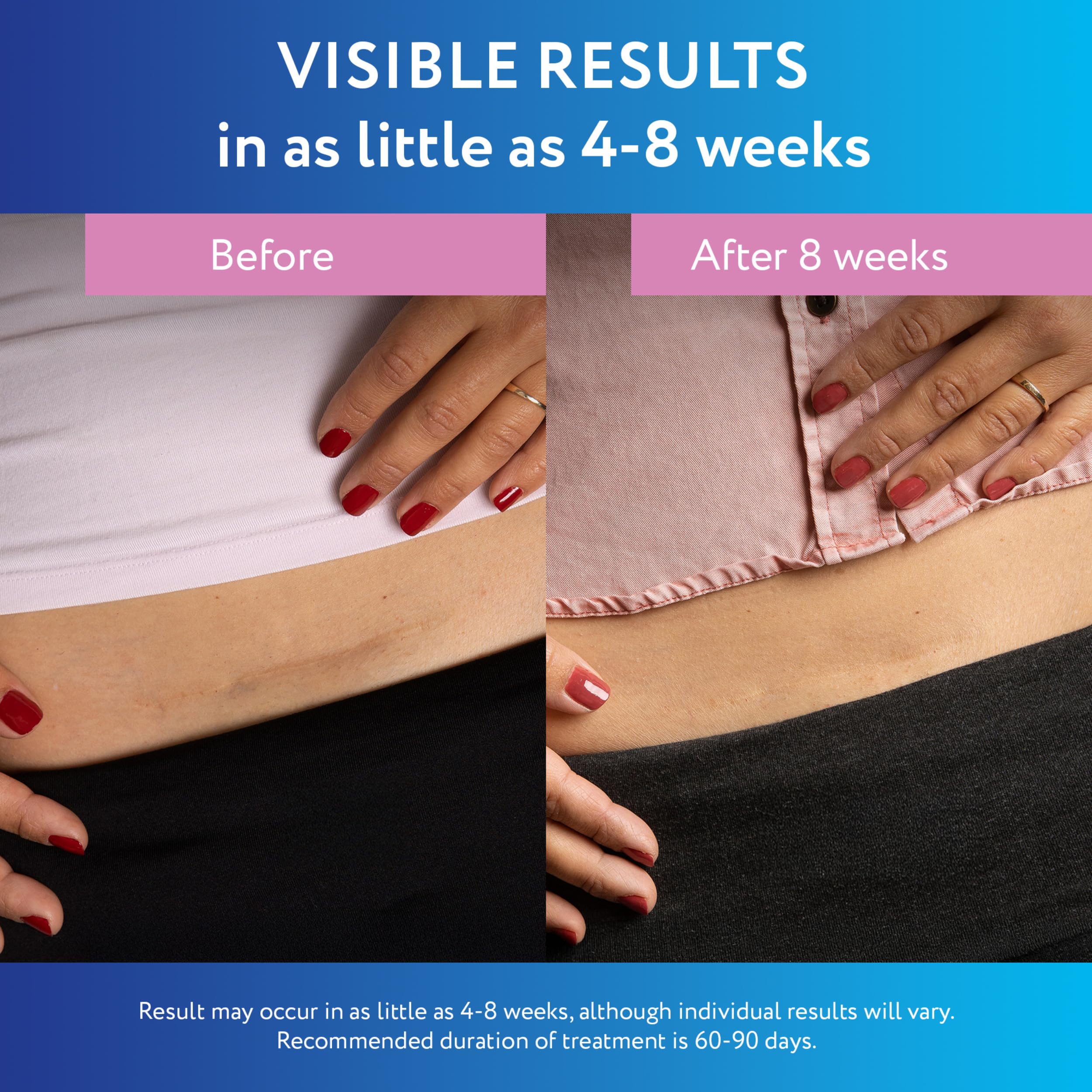 ScarAway sheets remove gently from delicate skin without pulling.