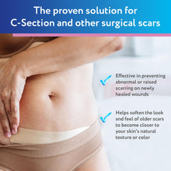 ScarAway sheets on the abdomen showing breathable, soft fabric.