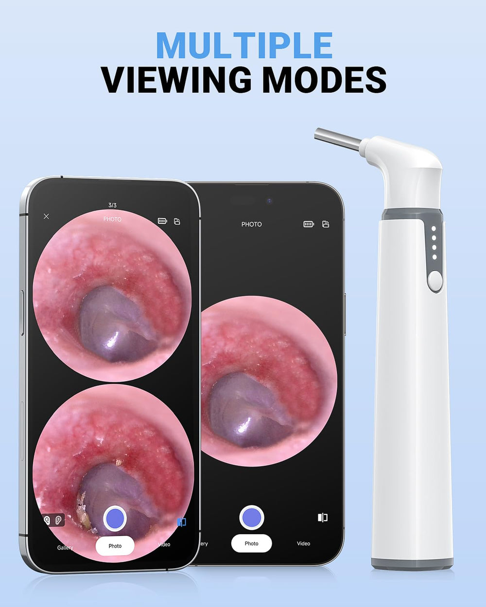 ScopeAround included specula and lighting support safe ear examinations at home.