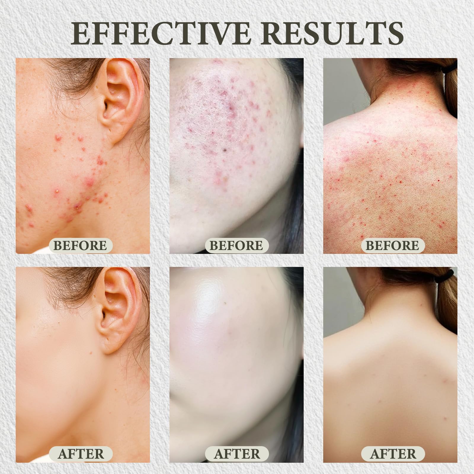 SDXJIOGE arnica active visual suggests calming redness relief.
