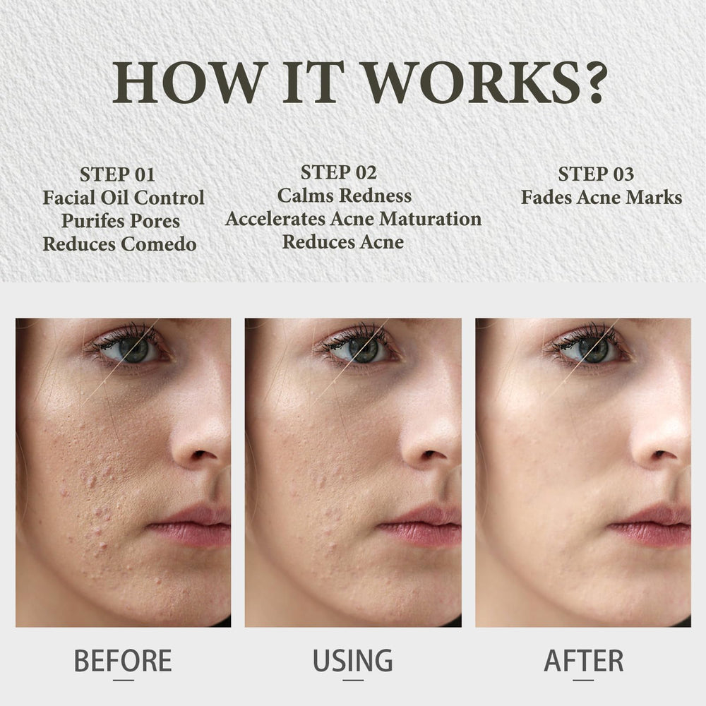 SDXJIOGE morning routine with balm application.