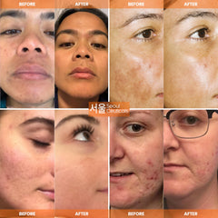 Swirl of SeoulCeuticals serum on skin indicating hydration