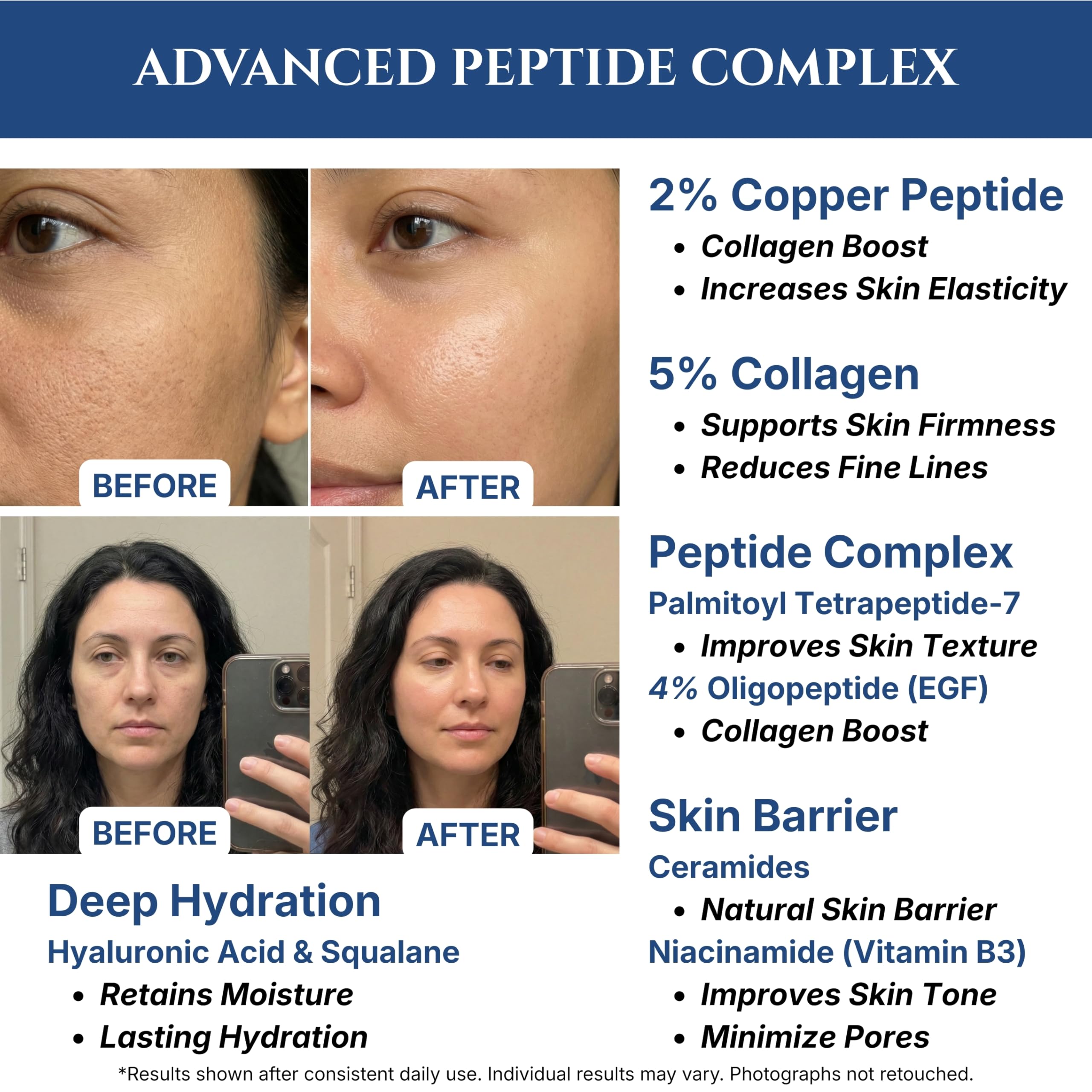Seraphime ingredients highlight niacinamide and EGF for refined texture