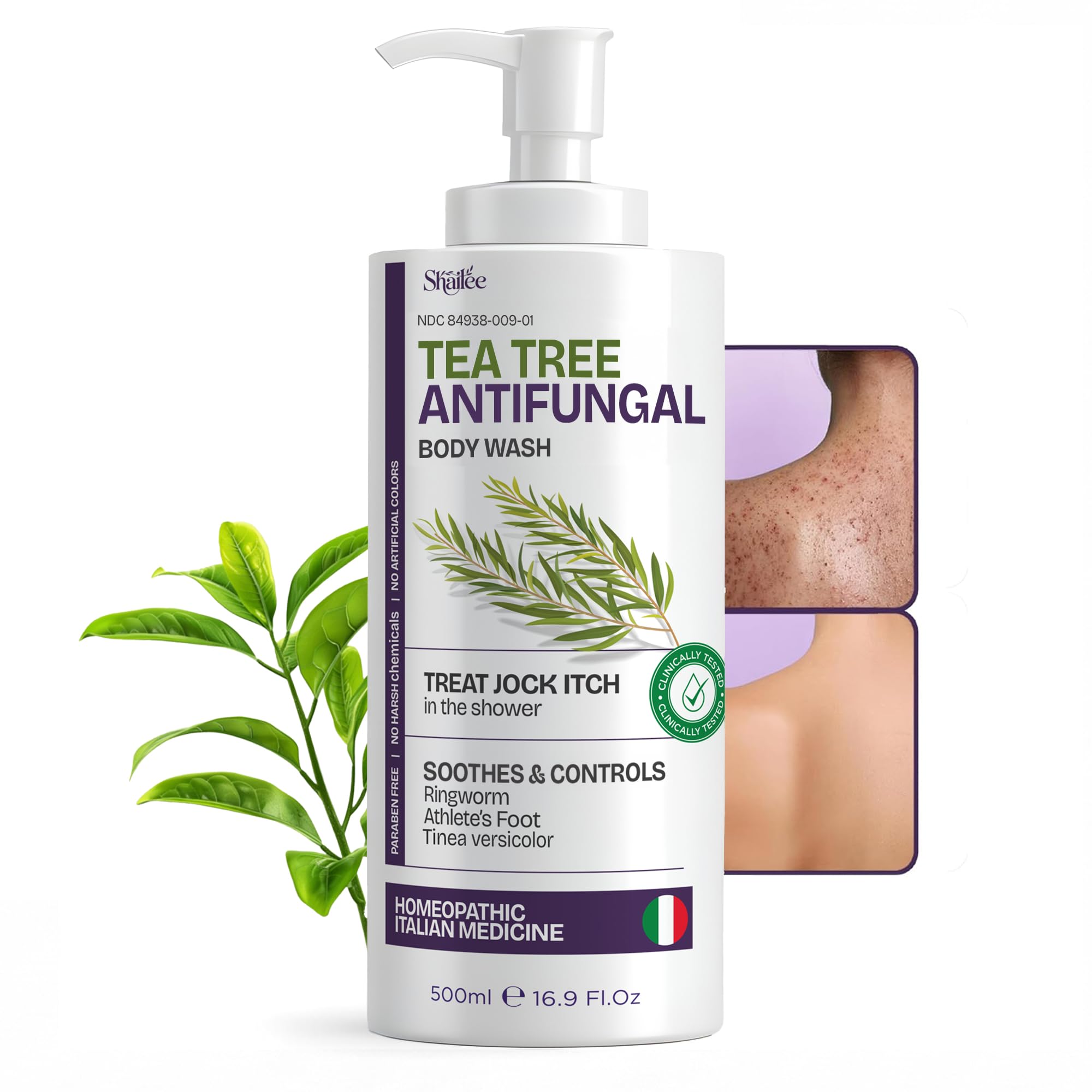 Shailee antifungal tea tree body wash bottle for eczema-prone skin.