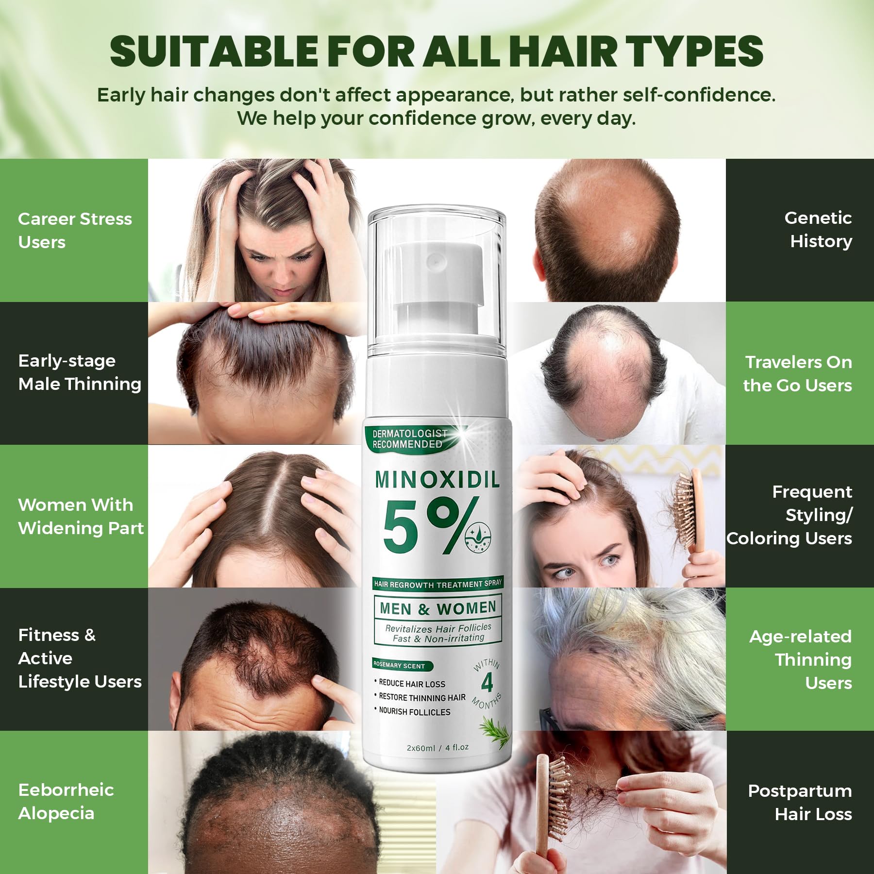 SHIUMORE Minoxidil daily-use routine setup in a grooming space