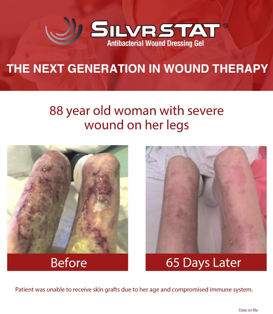 SilvrSTAT gel in a travel first aid kit setup