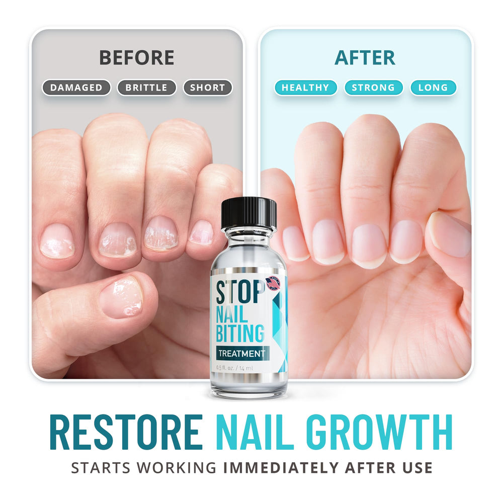 SISQUOC HEALTHCARE Stop Nail Biting clear coat supporting healthy nail growth