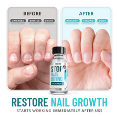 SISQUOC HEALTHCARE Stop Nail Biting clear coat supporting healthy nail growth