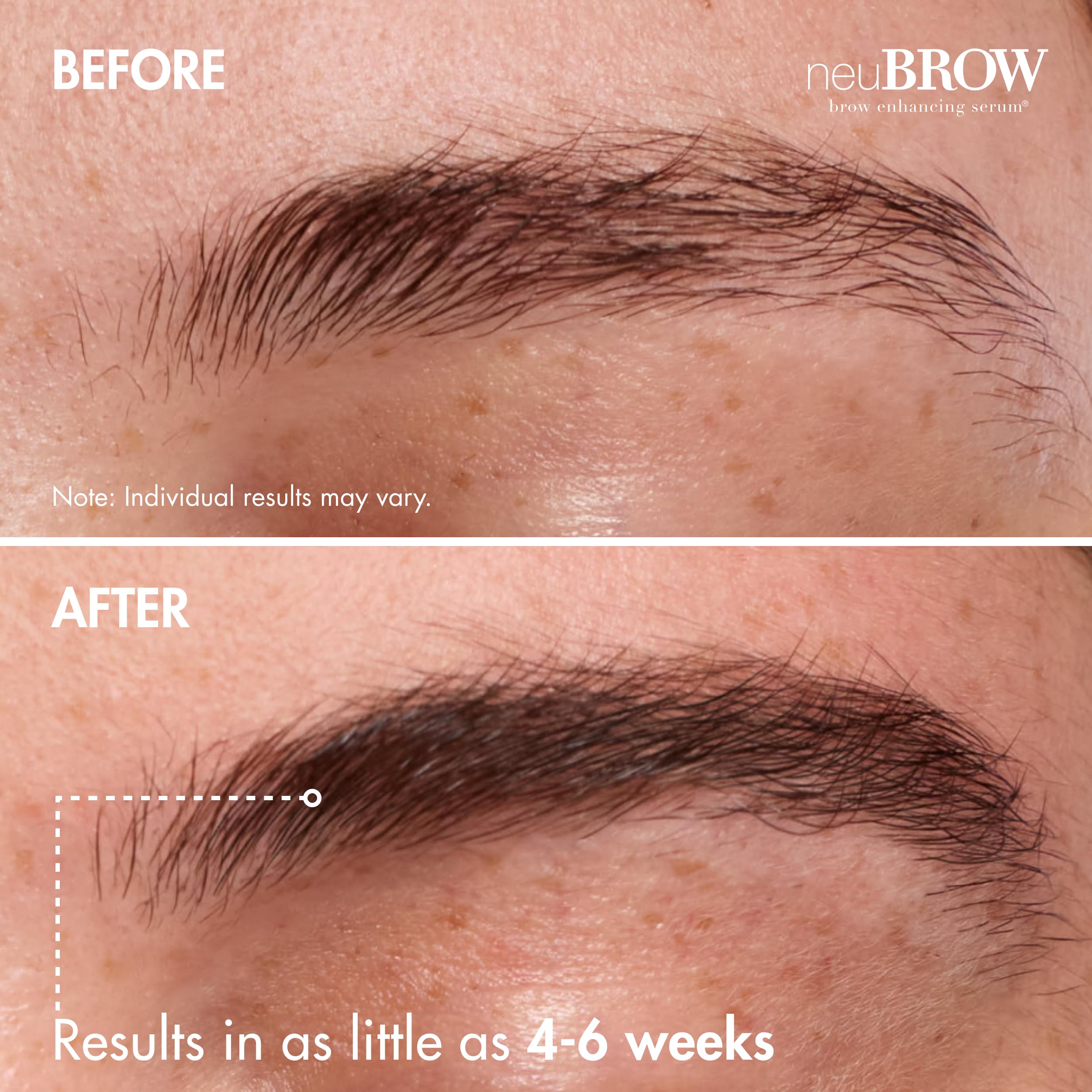 NeuBROW brow area with fuller, defined look.