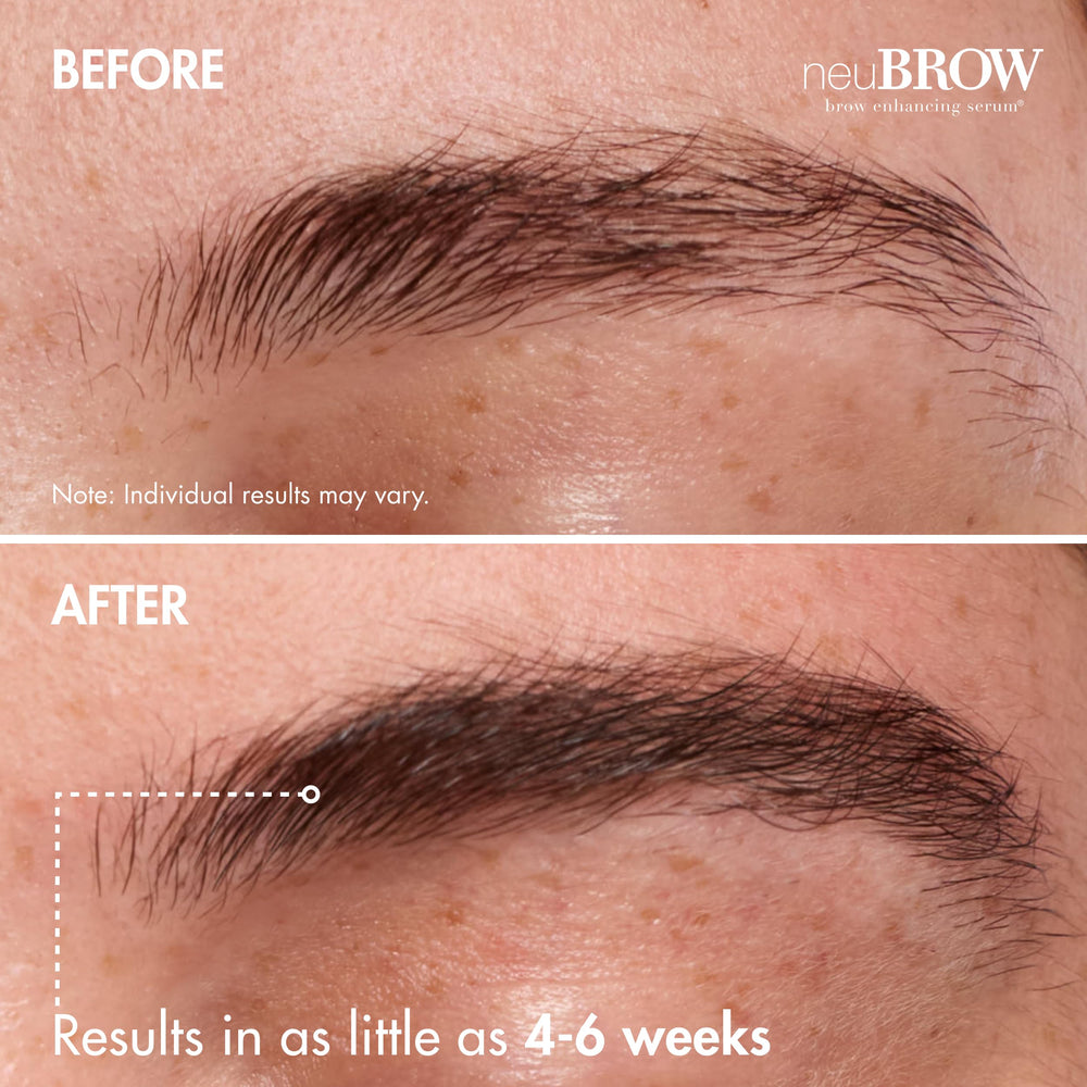 NeuBROW brow area with fuller, defined look.