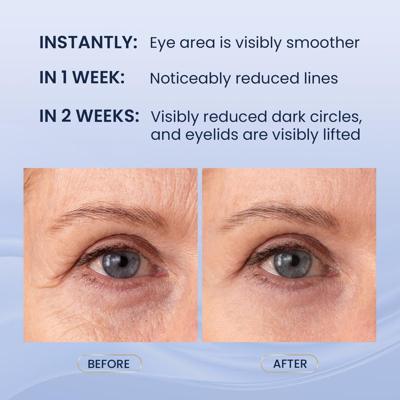SKIN ULTIMA lower eye cream smoothing puffiness and dark circles