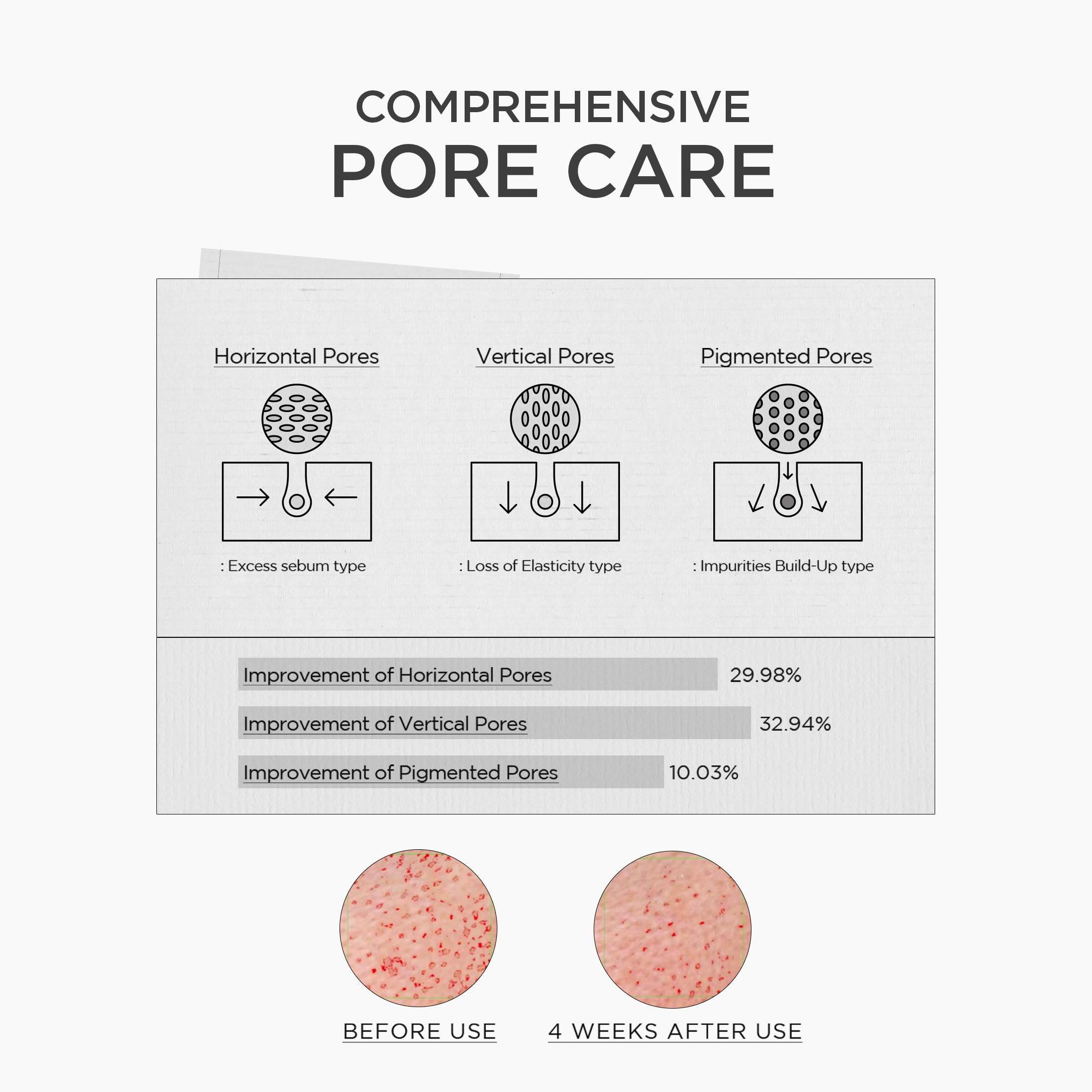 SKIN1004 Spicule serum application on clean skin for nourishment.