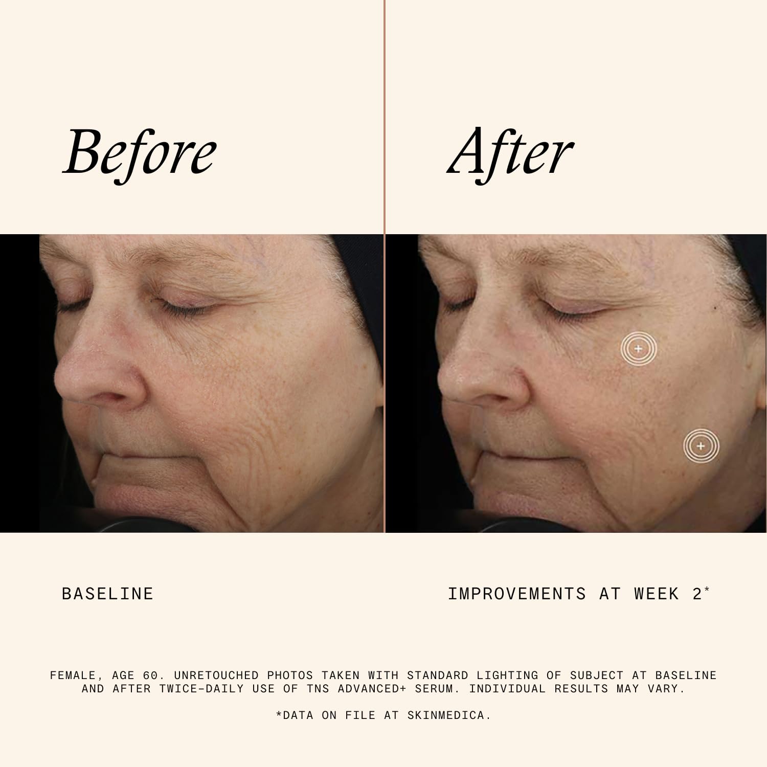 NEW packaging of SkinMedica TNS Advanced+ Serum