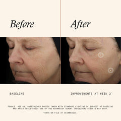 NEW packaging of SkinMedica TNS Advanced+ Serum