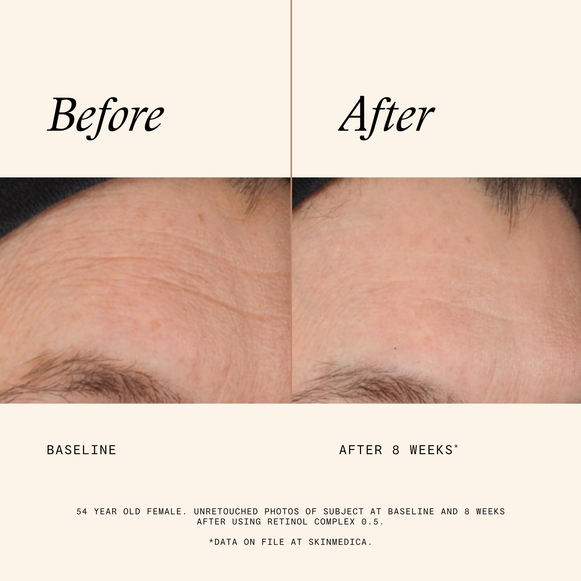 SkinMedica Retinol 0.5 Complex ingredients list on card