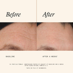 SkinMedica Retinol 0.5 Complex ingredients list on card