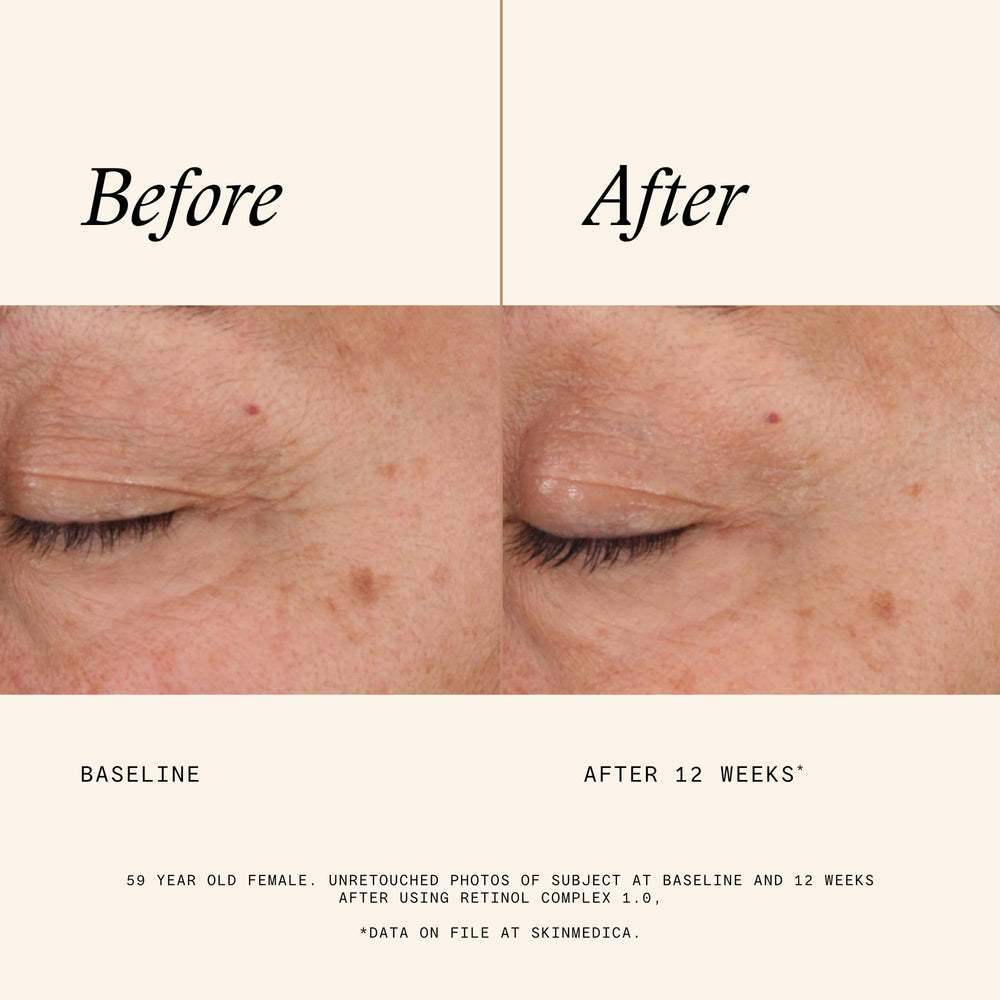 SkinMedica Retinol 1.0 Complex texture close-up shows creamy consistency.
