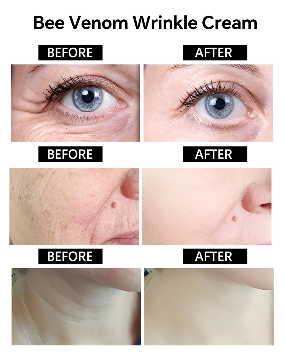 Skyoyo BotoxBee venom peptide illustration emphasizing renewed firmness and elasticity.