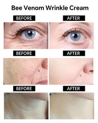 Skyoyo BotoxBee venom peptide illustration emphasizing renewed firmness and elasticity.