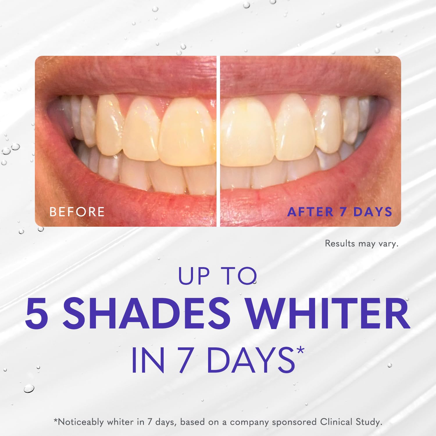 Smileactives Polyclean foam illustrating full-tooth whitening across surfaces