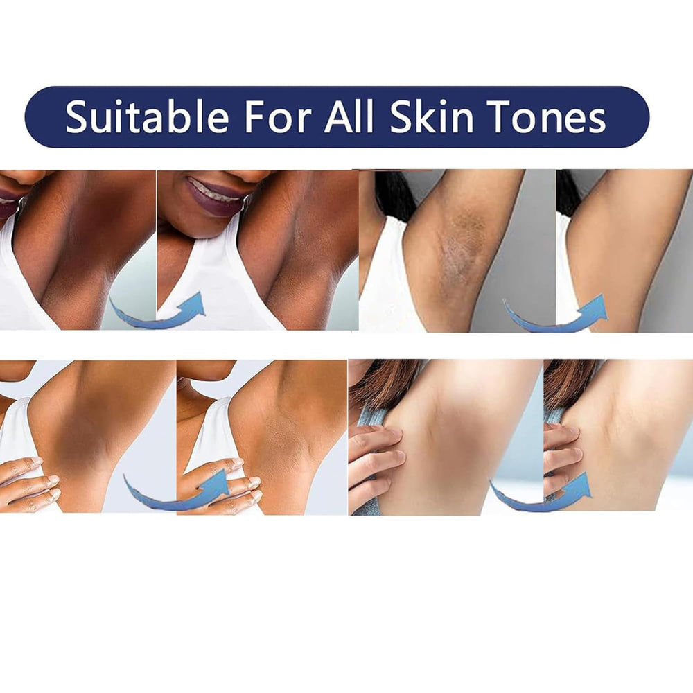 SMILEFACE bikini area cream closeup supports safe, discreet skin lightening.