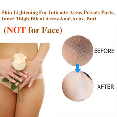 SMILEFACE inner thighs cream bleaching highlights even-toned results in sensitive areas.