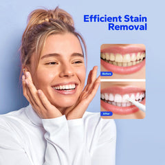 SmileShark twist-activated applicator delivers precise, mess-free gel application anywhere.