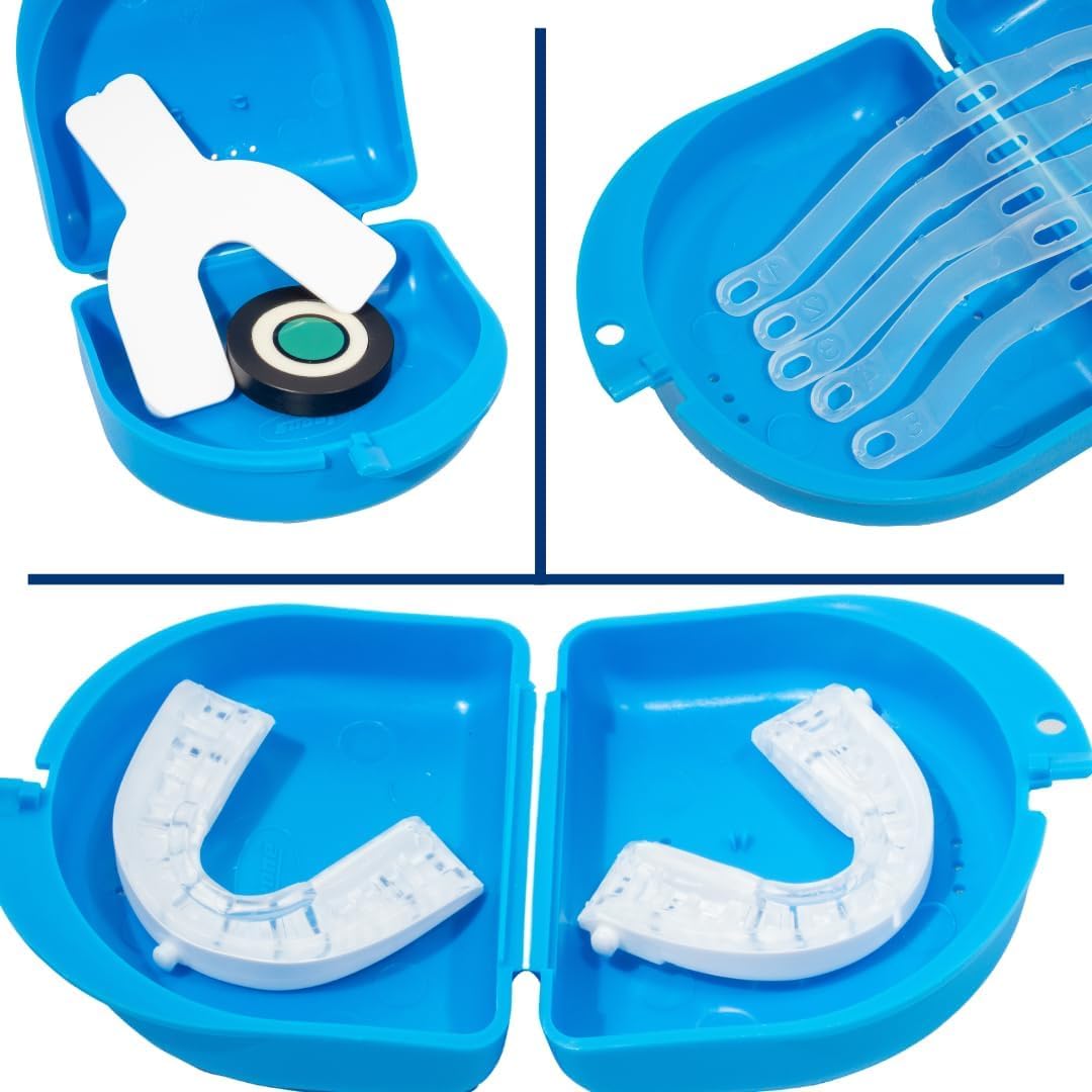 SnoreLessNow Somnofit adjustable-strap ensures secure night-long wear.