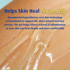 Solarcaine Advanced Cooling Hydrogel cooling-relief calms skin after sun exposure