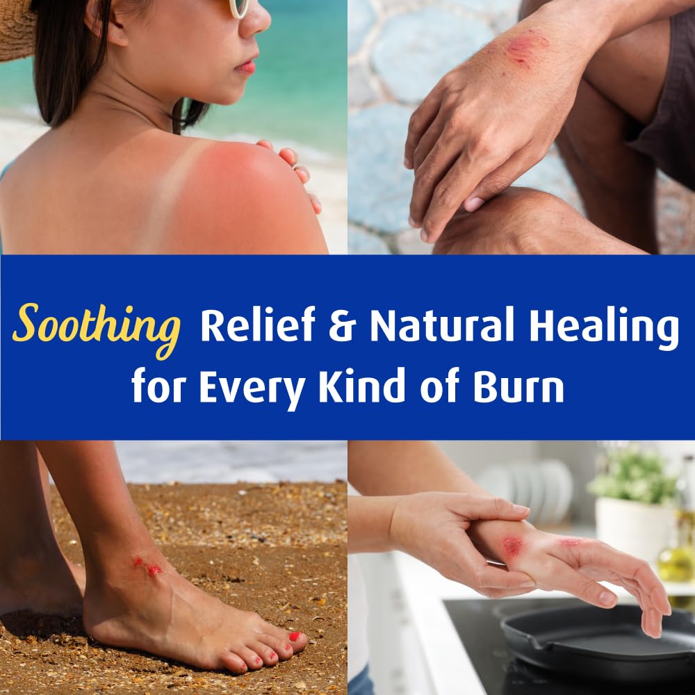 Solarcaine Advanced Cooling Hydrogel face-body-use safe on cheeks or arms