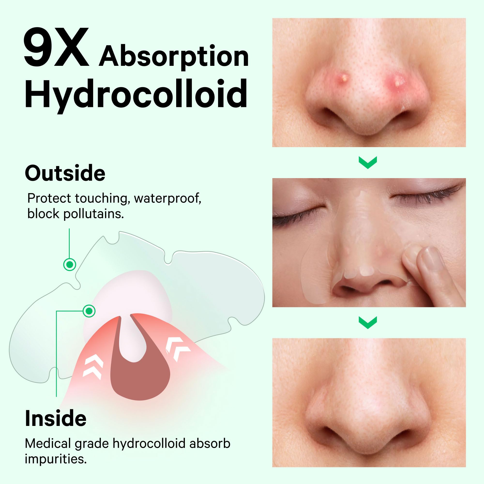 Sosky nose patch four-hour effect visualizing pore refinement and blemish reduction potential.