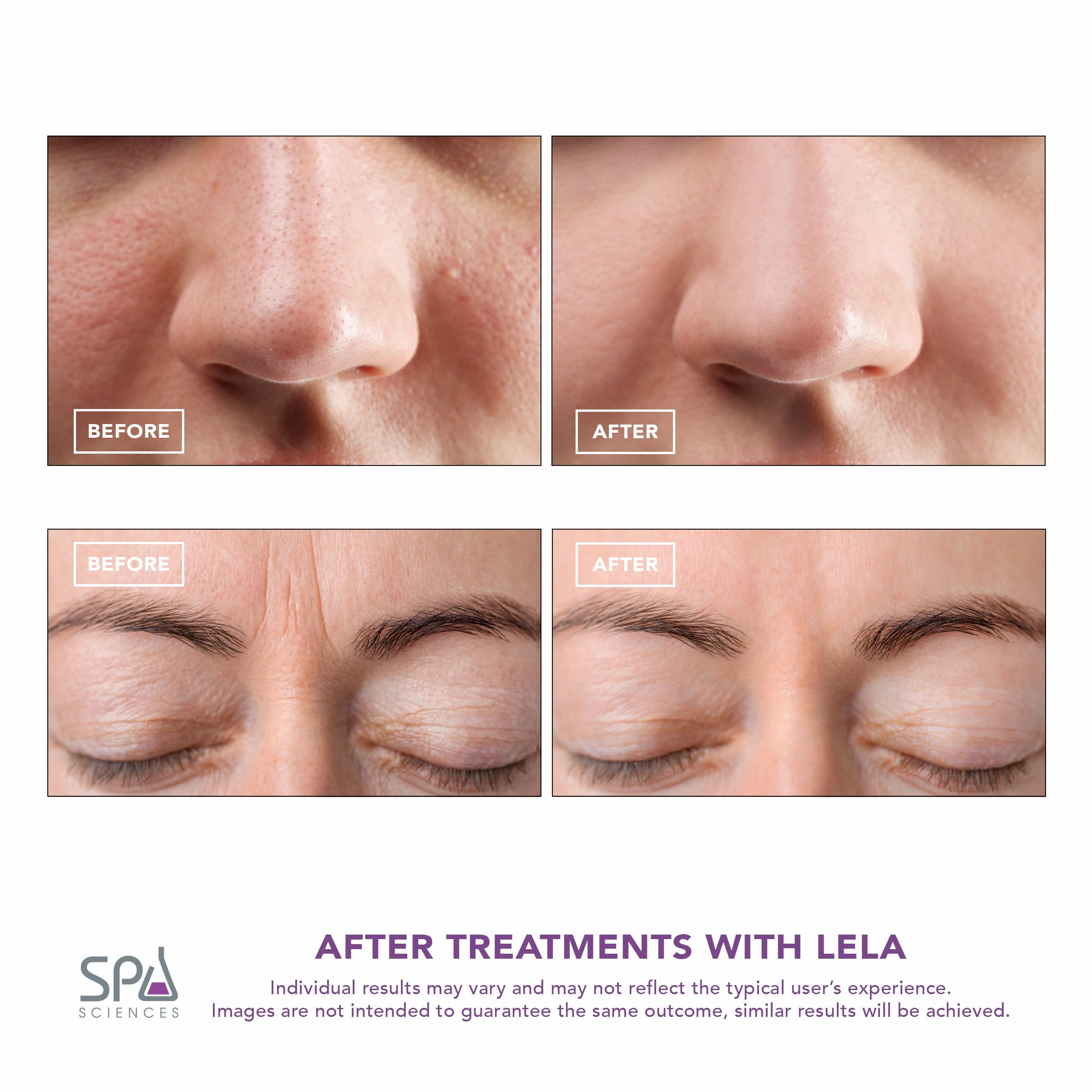 Spa Sciences LELA anti-aging contouring for a lifted-looking complexion