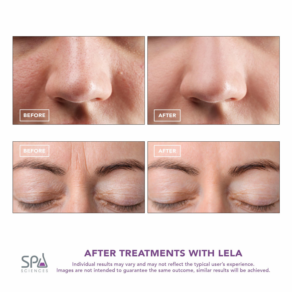 Spa Sciences LELA anti-aging contouring for a lifted-looking complexion