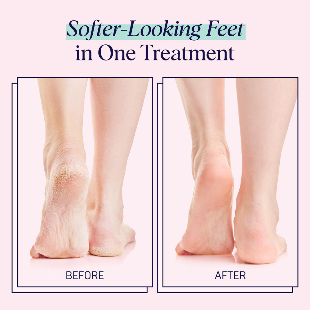 Overnight SpaLife foot sockies therapy for deeper hydration.