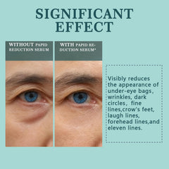 Spec Ask Instant Eye Lift Serum being applied under the eye to reduce puffiness.