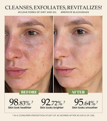 Srripo walnut shell powder exfoliating particles shown for gentle exfoliation.