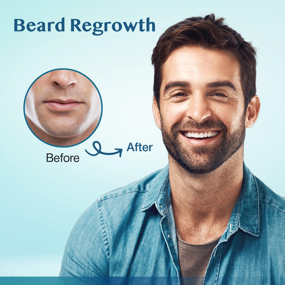 Stafenit beard regrowth application on facial hair during daily routine
