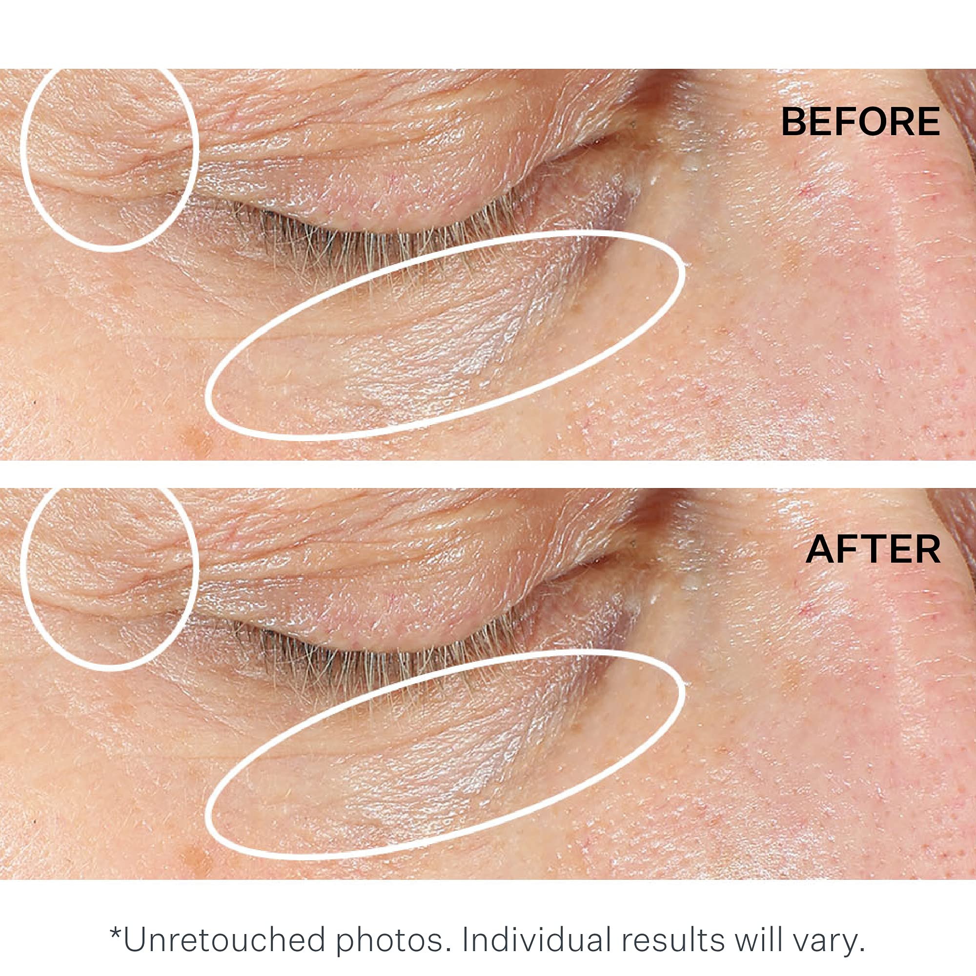StriVectin NIA-114 technology concept visual suggests barrier-boosting care for eyes
