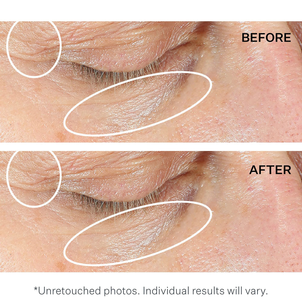 StriVectin NIA-114 technology concept visual suggests barrier-boosting care for eyes