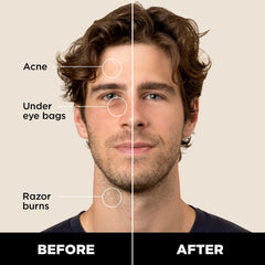 Stryx Concealer Tool twist mechanism delivers precise amount for clean, controlled coverage